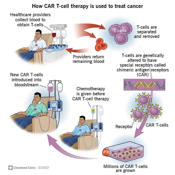 CAR T cell therapy | Learn Cytometry CAR T cell therapy